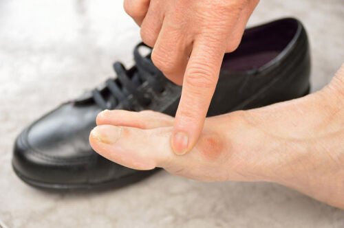 Tại sao giày bảo hộ lại hay gây đau chân? Cách khắc phục đơn giản